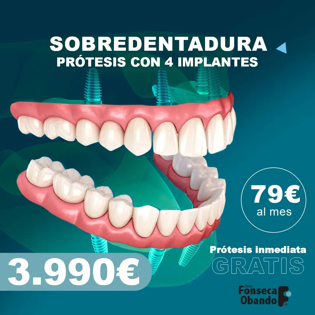 Sobredentadura en clínica Fonseca y Obando